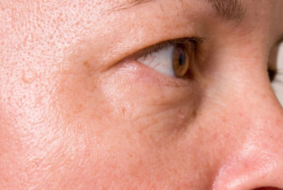 A man showing before and after effects of using Morganna Alchemy's cream